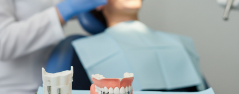 Dental implants imagic dental clinic palakkad