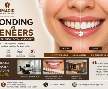 Dental bonding vs veneers comparison banner with before and after smile, Imagic Dental Lounge Palakkad