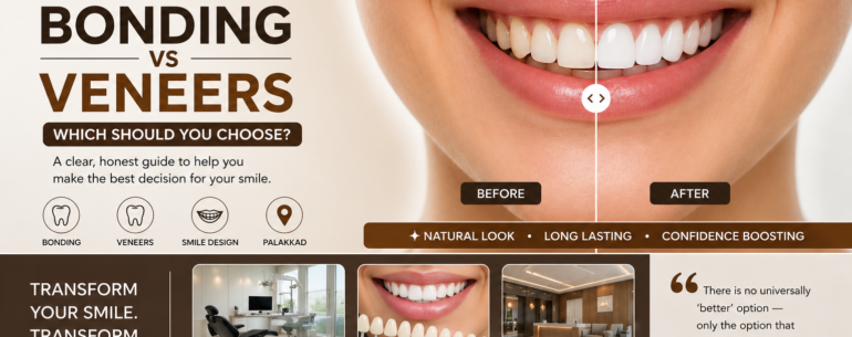 Dental bonding vs veneers comparison banner with before and after smile, Imagic Dental Lounge Palakkad