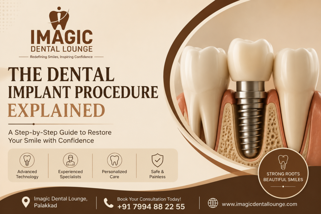 Dental Implant