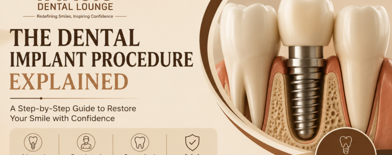 Dental Implant